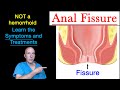 Anal Fissure Causes Symptoms Diagnosis And Treatment