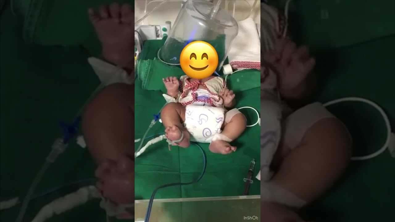 NICU