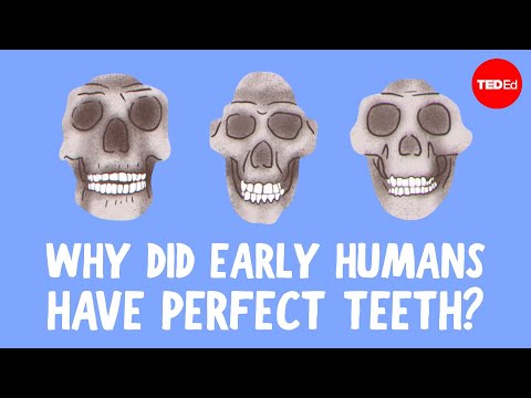 Why Did Our Ancestors Have Better Teeth Than Us?