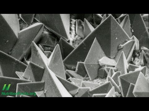 How to Prevent Kidney Stones With Diet