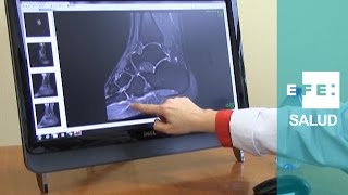 ¿Cómo se previene el dolor en la planta de los pies