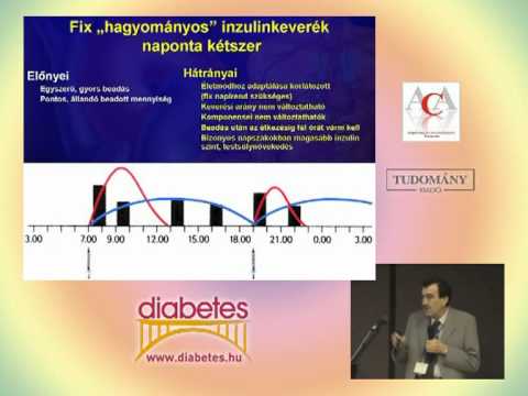 Az inzulinpumpa a cukorbetegség kezelésében