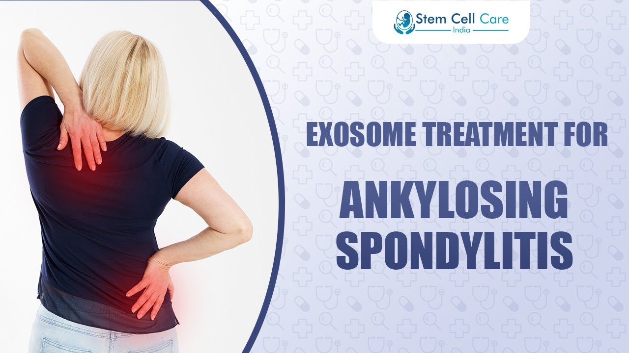 Exosome Therapy for Ankylosing Spondylitis | Advanced Regenerative Treatment 