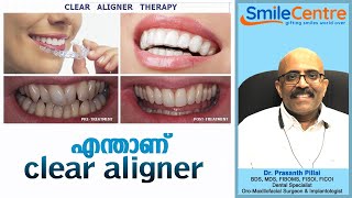 Clear aligner - Video