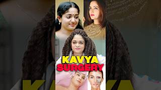 കാവ്യയുടെ രൂപമാറ്റത്തിന്റെ പിന്നിലുള്ള രഹസ്യം Kavya Madhavan Now And Then #viral #trending #shorts
