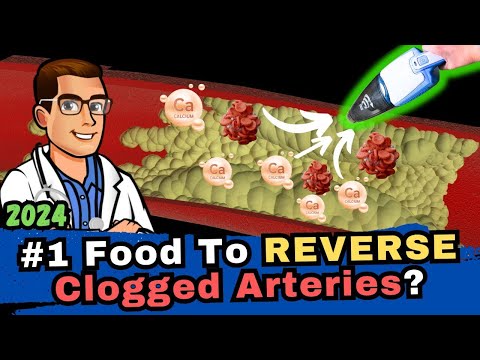 #1 Food To REVERSE Arteriosclerosis, Blood Clots & Clogged Arteries?