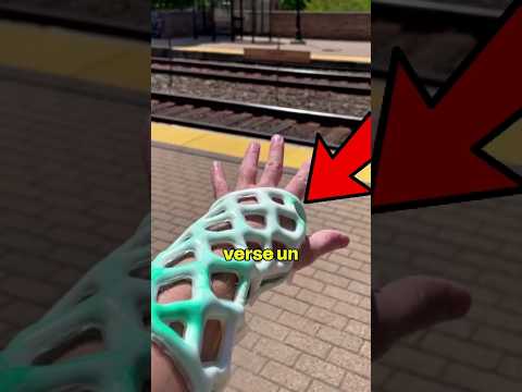 Esto podría reemplazar tu feo yeso y es mejor