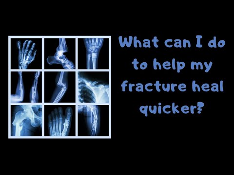 What can I do to help my fracture heal quicker?