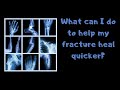 What can I do to help my fracture heal quicker?