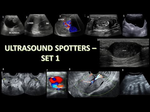 MUST KNOW ULTRASOUND SPOTTERS || SET 1