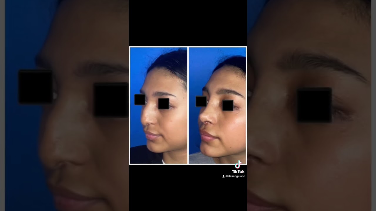 Itza Antonio Anguiano Castrejon-15