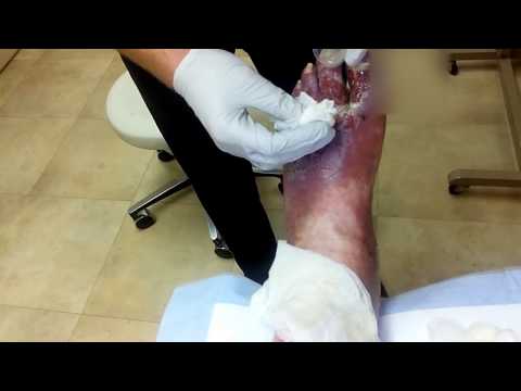 leg cleaning from 8/08/16 (warning graphic)