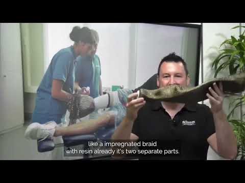 Virtually Speaking about....Limb Fitting Solutions with Ossur