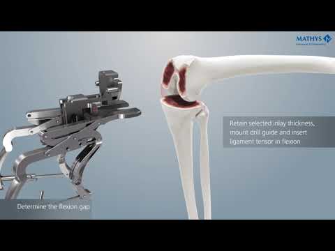 Mathys: balanSys BICONDYLAR Knee System – Ligament Tensor