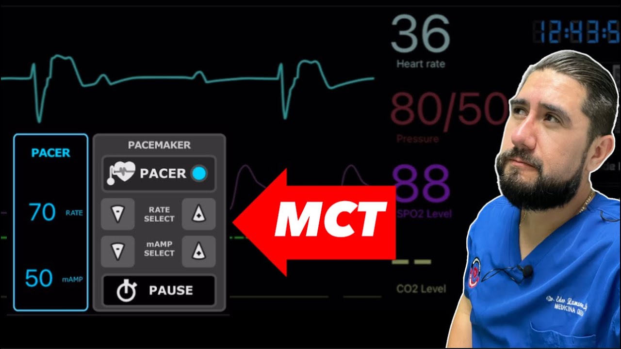 MARCAPASOS TRANSCUTANEO ⚡🫀|Mini Taller de Simulación