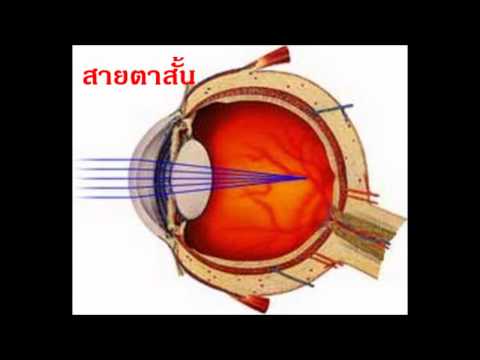 อุปกรณ์เพิ่มสมาชิก เทคนิคการเพิ่มอวัยวะเพศชาย