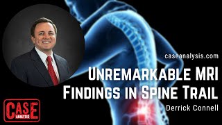Derrick Connell - Unremarkable MRI Findings in Spine Trail