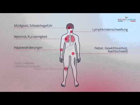 Was GMR Vorrichtung für Gelenke PS Salbe für Gelenke