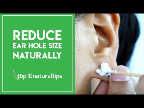 download lagu mp3 mp4 How To Reduce Ear Hole Size Naturally, download lagu How To Reduce Ear Hole Size Naturally gratis, unduh video klip Download How To Reduce Ear Hole Size Naturally Mp3 dan Mp4 320kbps Gratis