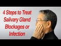 4 Steps to Treat Salivary Gland Swelling at Home