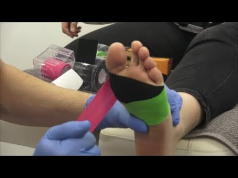 Podo-Taping-Concept© - Interdigital - Hühnerauge (Variante 2 und 3)