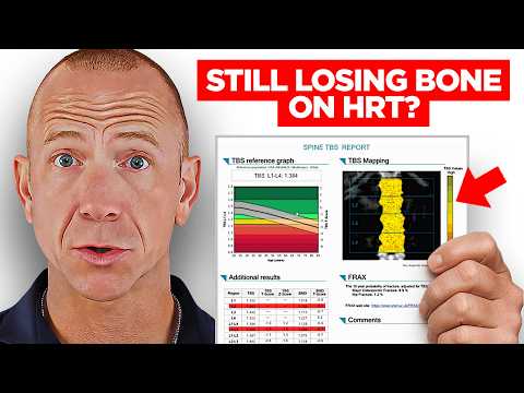 Die Wahrheit über Hormone, Wechseljahre und Knochenstärke