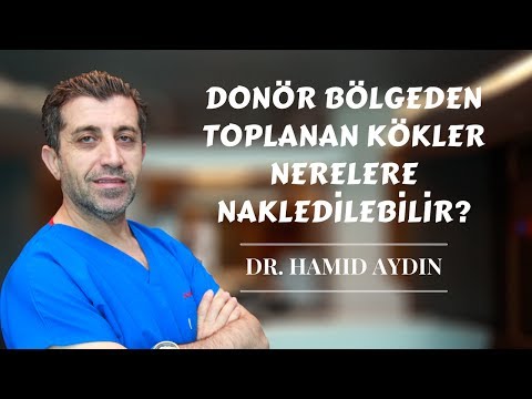 Donör bölgeden toplanan kökler nerelere nakledilebilir? - Dr.Hamid AYDIN
