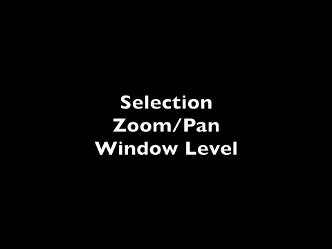 6. Home Function I - Selection, Zoom_Pan, Window Level