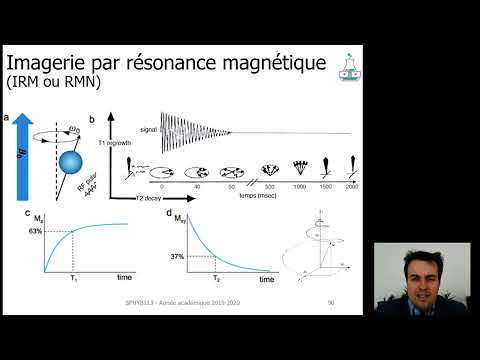 IRM Expliquée : Comment Fonctionne l'Imagerie par Résonance Magnétique ?