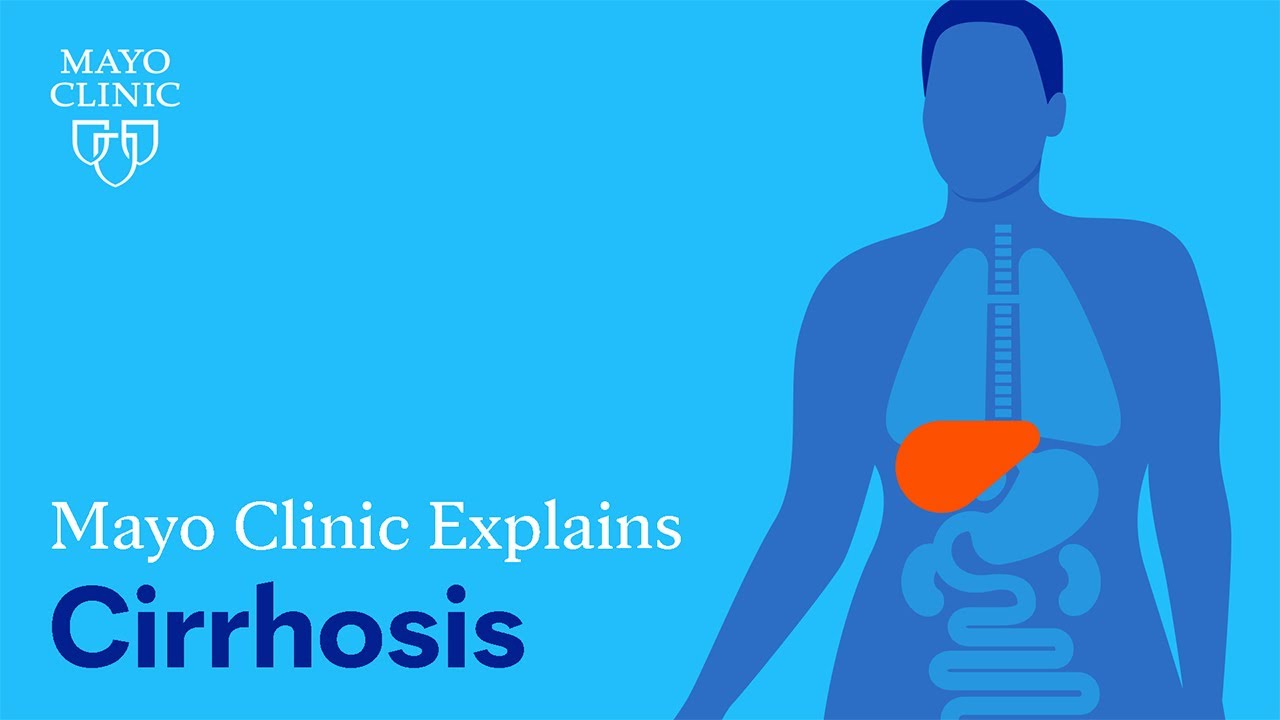 Mayo Clinic Explains Cirrhosis