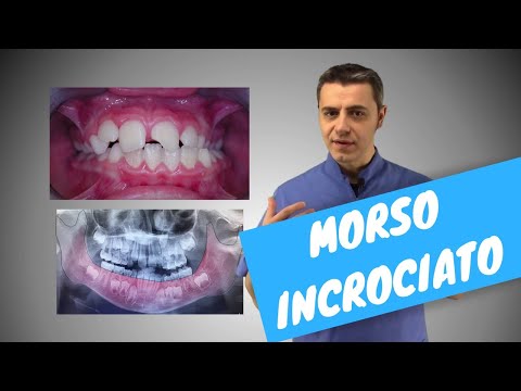 Iniezioni diprospan nel prezzo articolazioni Soluzioni per migliorare la circolazione cerebrale allosteocondrosi