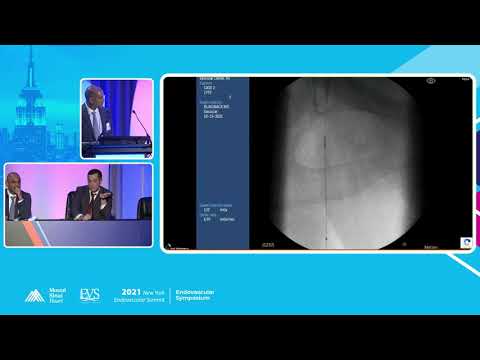 LIVE CASE PRESENTATION #4 COMMON FEMORAL ARTERY - John H  Rundback, MD