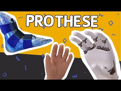 WAT ALS JE GEEN HANDEN OF ARMEN HEBT? // Willem Wever // #30