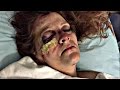 Woman Survives Being Nearly Beaten To Death By Ex Husband