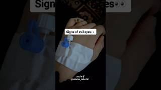 signs of evil eyes 🥺❤️‍🩹