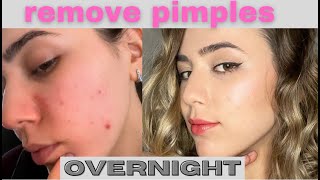 HOW TO REMOVE PIMPLES overnight acne treatment