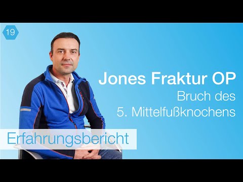 #19 Was tun bei Jones Fraktur? -  Therapie | Symptome | Dauer