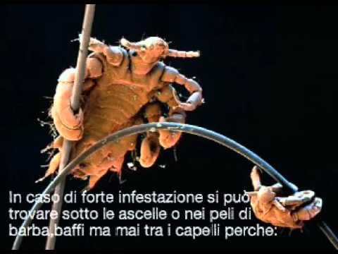 Il più gran helminth della persona Infezione con vermi da carne rozza