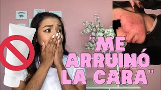 ¡Me quemó la cara! | Cremas milagrosas Pt. 1