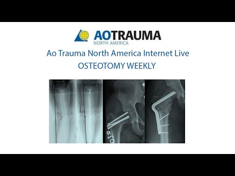 Week 2 Ask the experts: April 30 Deformity Evaluation (Cont)