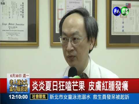 吃4顆芒果 男急性蕁麻疹險送命!