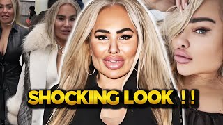 Darcey Silva Shocks Fans With Alien Face Following New Plastic Surgery
