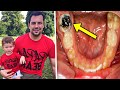 Father Ignores Pain In One Tooth – Days Later He Passes Away And Dentists Figure Out Why...