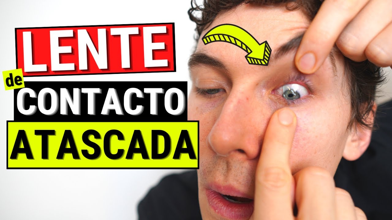 Cómo quitar una lente de contacto ATASCADA del ojo