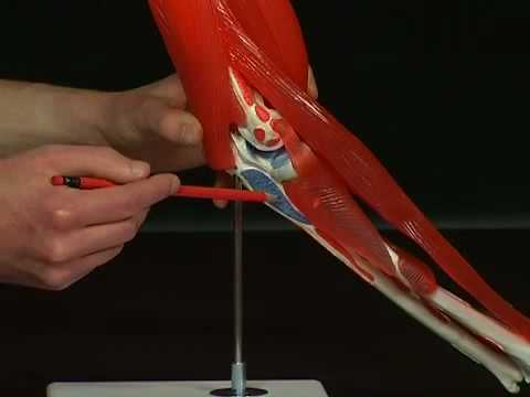 Orthopädische Bandage auf der Hüfte Als wunden Arm von Osteochondrose