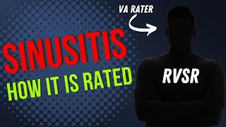 A rater reviews how sinusitis is rated 0 to 50%