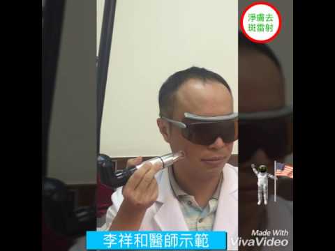 淨膚去斑雷射-士林醫美優儷芙診所-李祥和醫師示範02-28363314
