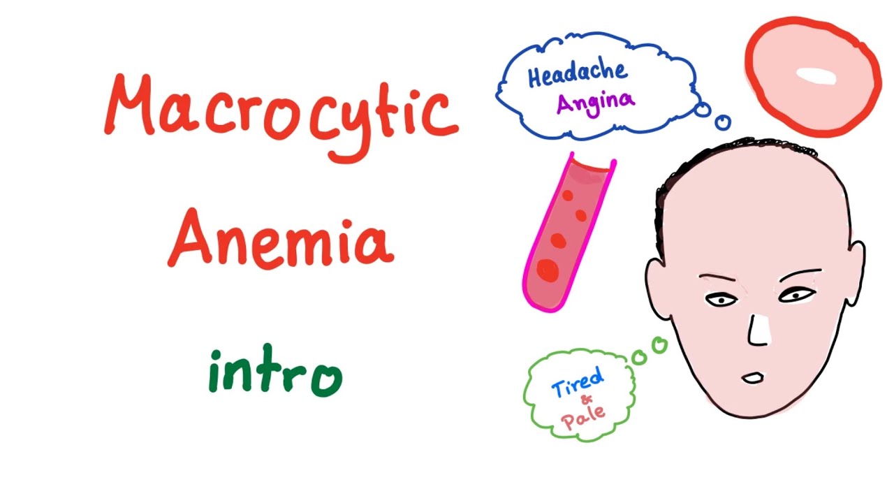 Macrocyctic Anemia Intro