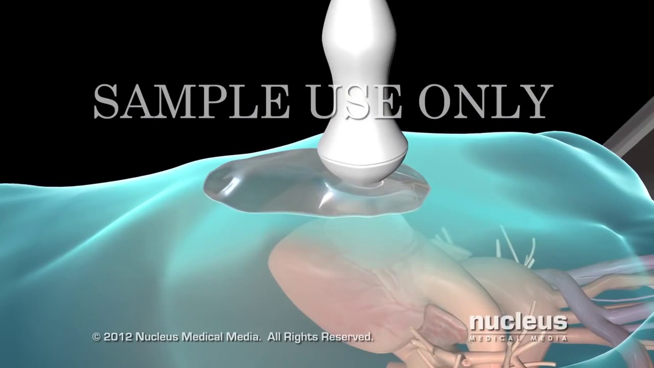 Hugo Molina Zamora-9