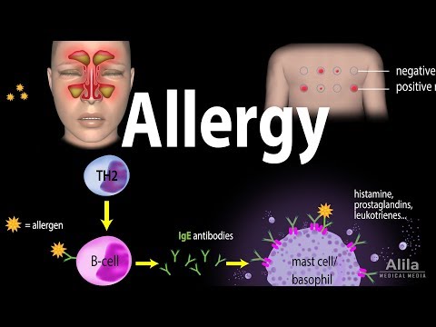 Allergy - Mechanism, Symptoms, Risk factors, Diagnosis, Treatment and Prevention, Animation